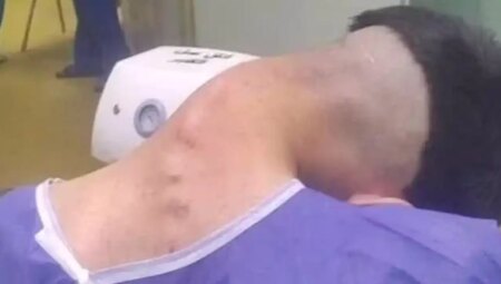 Bağımlılığın sonu ‘baş düşmesi’ sendromu oldu